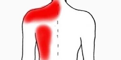 fájdalom a bal lapocka alatt hátulról