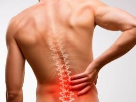 alsó hátfájás osteochondrosis miatt